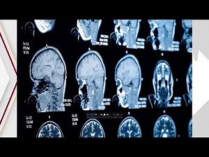 Neuroscience Nurse Practitioner Program with UCSF