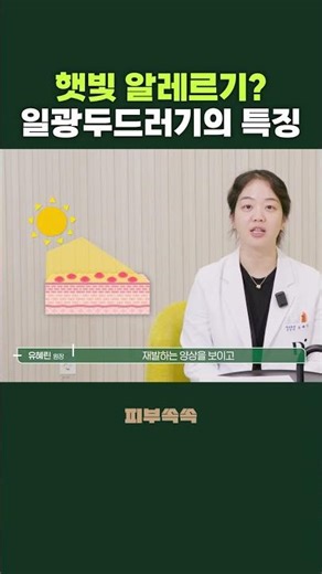 햇빛 알레르기의 특징