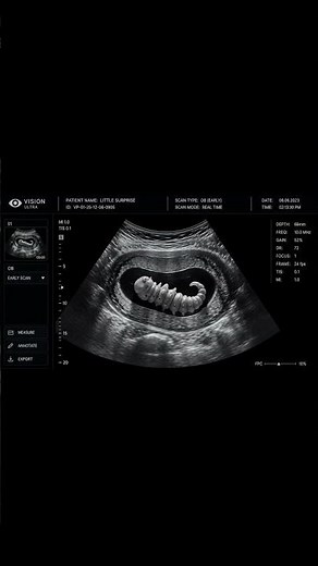 Fake ultrasound scan prank #fakeultrasound kids