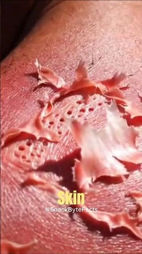 Why Your Skin Peels After a Sunburn 🔥 | The Gross Truth 😳#Sunburn #SkinFacts #ScienceShorts