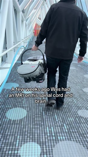 MRI Results for Caudal Regression Syndrome Explained