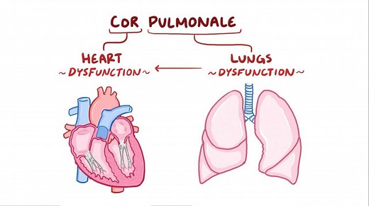 Video: Cor pulmonale - Video Explanation! | Osmosis | Osmosis
