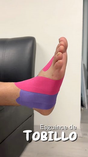 Kinesio taping helps stabilize the ankle by providing gentle tension on the skin that stimulates proprioceptive receptors. This enhances the awareness of movement and joint position, promoting better muscle activation. Additionally, it guides ankle motion, reduces stress on injured structures, and offers a sense of support without limiting mobility. #kinetape #ankle #kinesiotape | Kinetape Academy