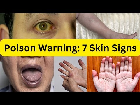 7 Skin Signs of Poisoning You Should NEVER Ignore | Life-Saving Health Warnings
