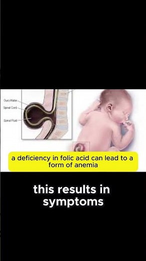 Folic Acid Deficiency Symptoms and Risks #healthtips #healtheducationlibraryforpeople #healthy