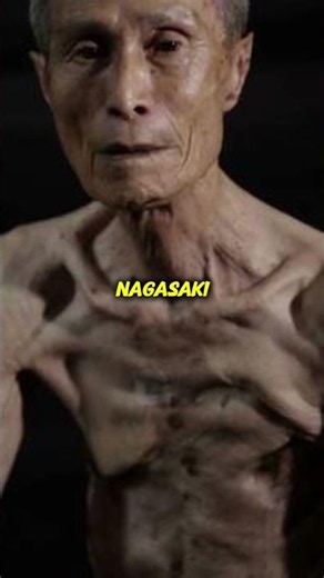 Imagine Surviving Two Nuclear Explosions☢️