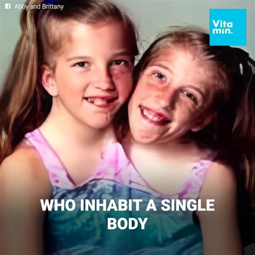 “They felt an arm and then they felt another arm and then they felt what they thought was another arm, and then…” They are treated like freaks. Everything changes when people see them up close. This body houses two twins. Abigail and Brittany Hensel are dicephalic conjoined twins. A unique condition in the world. From birth, their lives have been at risk. But they haven’t given up on their dreams. | The Witness
