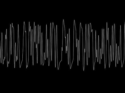 Look At You Mr. Hotshot put through an Ibanez Tube Screamer