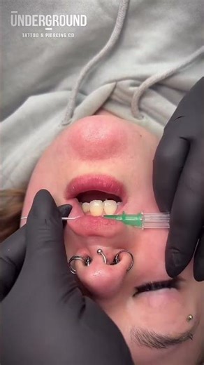 Would you get a smiley piercing?