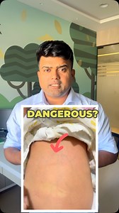 86K views · 148 reactions | Noticing a small bulge on your baby’s...
