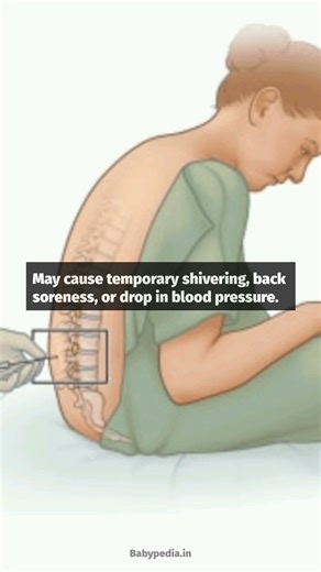 Should we choose Epidural? #epiduralinjection #epidural #viralshorts
