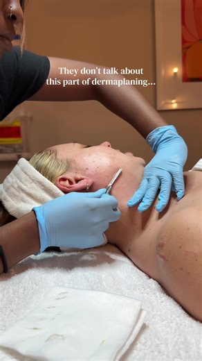 Dermaplaning isn’t meant to be the final step it’s the prep step. By removing dead skin and surface buildup, it creates the perfect foundation for treatments like DiamondGlow, chemical peels, microneedling, and lasers to work better and deliver stronger results. On its own? Dermaplaning is nice. Combined? It’s powerful. This is how we build smoother texture, brighter tone, and long-term skin results not just a temporary glow. If you’re serious about your skin, prepping it properly matters ✨ Book