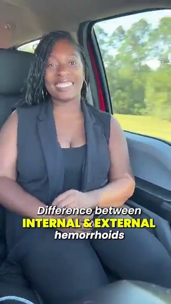 Internal vs External Hemorrhoids: What’s the Difference?