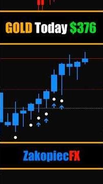 GOLD How I made $376 today!