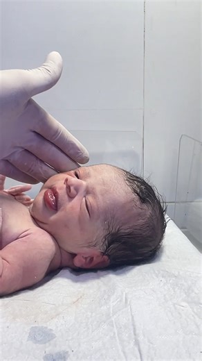 49K views · 1.3K reactions | Hungry Baby in NICU – First Feeding Trial  #ba | Doctor Give birth | Facebook