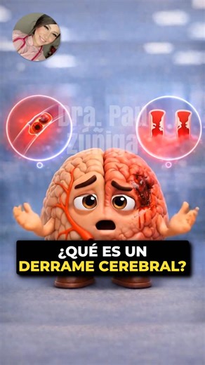 ¿Un derrame cerebral y una embolia cerebral son lo mismo? 🤔 Soy tu cerebro y aquí te lo explico 🧠 ✨ Saber distinguirlos es vital porque el tratamiento no es el mismo: los medicamentos que ayudan a disolver un coágulo jamás se podrían usar en una hemorragia, porque empeorarían el sangrado. Ahora cuéntame de cuál de los 2 te gustaría que hable más a fondo 👩🏻‍⚕️ #DerrameCerebral #Salud #Medicina #DraPauZúñiga #Embolia | Dra. Paulina Zúñiga