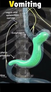 3D Animation of Vomiting