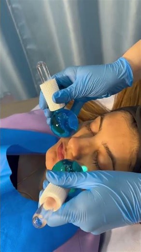Carbon Laser Treatment: The Secret to Clear, Glowing & Pore-Free Skin