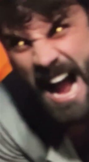 Bit by a Werewolf | Sora 2 Short