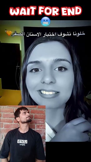 yellow teeth test 😱|#shorts