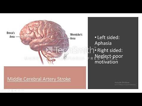 Paretic neurosyphilis