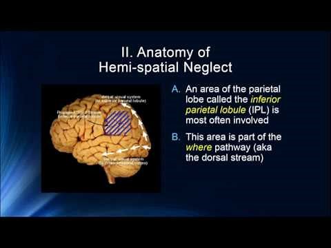 Cognition 3 6 Hemispatial Neglect & Simultagnosia