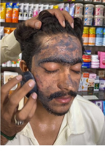 Acne Removal Soap Demo for Clear Skin