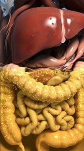 Your Belly Growing But Scale Isn't Moving? 😳 #liverhealth #ascites #health