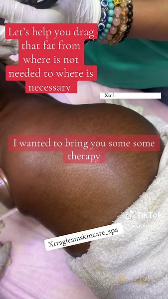 Cyst Treatment: Skin Care Procedure Explained