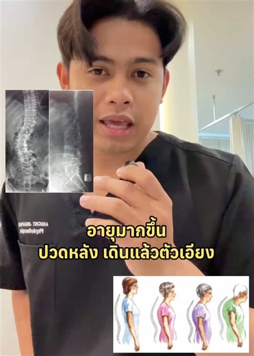 รู้หรือไม่? ผู้สูงอายุมีความเสี่ยงกระดูกสันหลังคดจากการเสื่อมสภาพ : นัดหมายตรวจคัดกรองกับนักกายภาพบำบัดได้แล้ววันนี้ 📌สาขาพระราม 9 คลินิกตั้งอยู่ที่ คอนโดลุมพินี เพลส พระราม9-รัชดา move on clinic มูฟออนคลินิกกายภาพบำบัด (Rama9) ⏰ คลินิกเปิดบริการทุก 10.00 - 19.00 น. สอบถามคิวว่าง Line: @moveonclinic 📞 0625198865 #moveonclinic #มูฟออนคลินิกกายภาพบำบัด #กายภาพบําบัด #กระดูกสันหลังคด #ผู้สูงอายุ