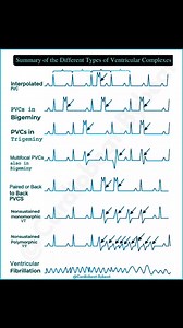 23K views · 3.1K reactions | Summary of the different types of...