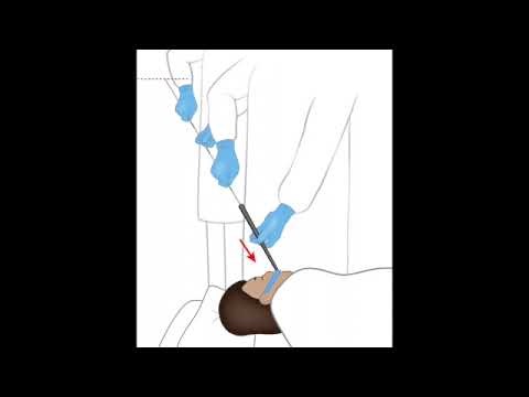 Podcast-55. EGD - Savory Dilation