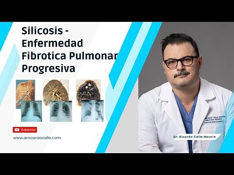 Silicosis: Enfermedad Fibrotica Pulmonar Progresiva