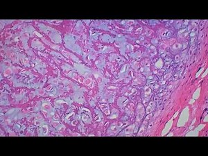 Tecido cartilaginoso