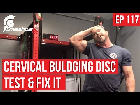 117 Cervical Bulging Disc Test & Fix It