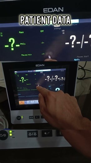 Edan X8 Patient Monitor ⚡ Quick Demo #Shorts