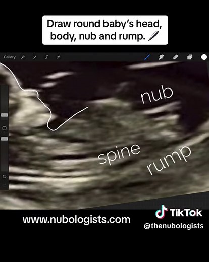 Girl or Boy? Nub Theory Explained