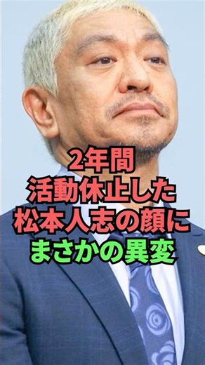 The shocking change in Hitoshi Matsumoto's face after his 2-year hiatus