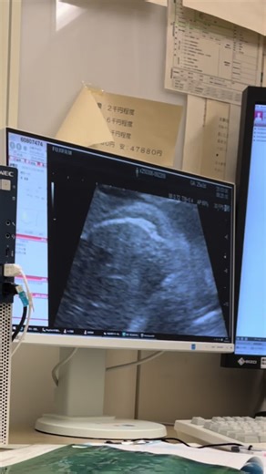 Hello Remi ちゃん🥰