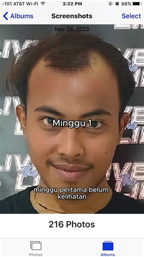 Solusi Rambut Rontok on TikTok