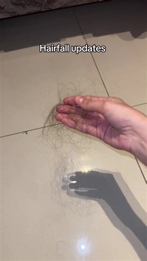 Effective Hairfall Solutions Using Capillus Serum