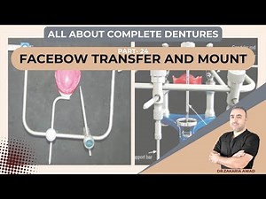 25- Facebow Transfer and Mounting: A Step-by-Step Guide for Complete Denture Fabrication - Part 25