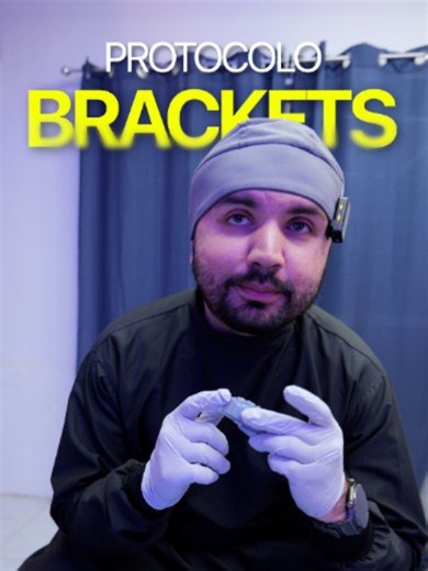 Como colocar brackets passo a passo