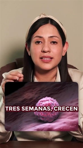 🚨 Ganglios: ¿infección o linfoma?