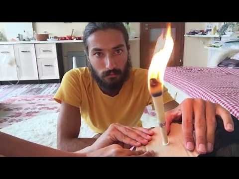 How to Clean the Ear Canal using Ear Cones / Candles with Jelio. Safe Way to Remove Dirt and Wax