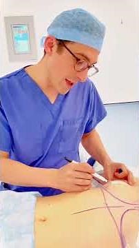 Breast Augmentation Dual Plane Technique - under the muscle & under the breast tissue