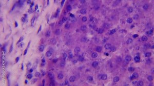 Liver. Under the microscope. 100x magnification. Vitamin metabolism and neutralization. Concept of human organ regeneration. Immortality