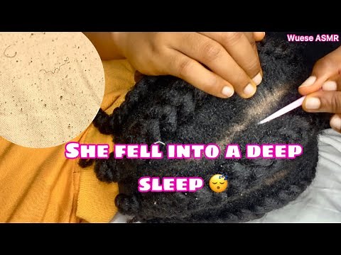 Very detailed and intense Asmr scalp scratching/nitpicking on old cornrows.(dandruff scratching)