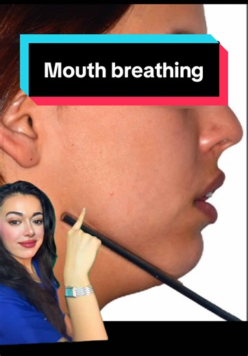 Understanding Mouth Breathing and Its Effects