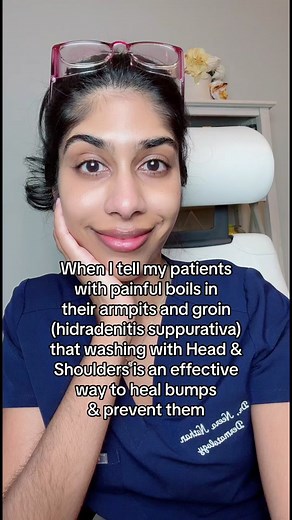 Hidradenitis suppurativa is a chronic inflammatory condition that presents as recurrent, painful lumps and boils on hair-bearing areas (like underarms or groin). It is aggravated by bacterial colonization of the skin. Pyrithione zinc-based shampoos, like Head & Shoulders, can be used on the affected skin to help reduce inflammation and bacteria, which helps to get rid of boils and can prevent them from coming back. This is a cheaper treatment option than Hibiclens, which can also help hidradenit